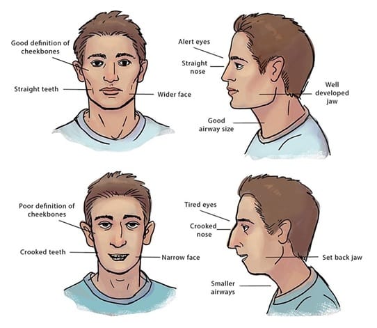 Stryx  Do Jawline Exercises Actually Work? Here's What to Know